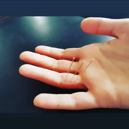 Révisions cliniques et punctures difficiles