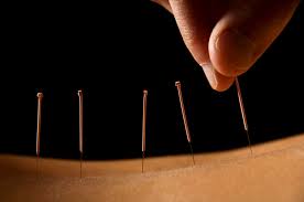 Révisions cliniques et punctures difficiles